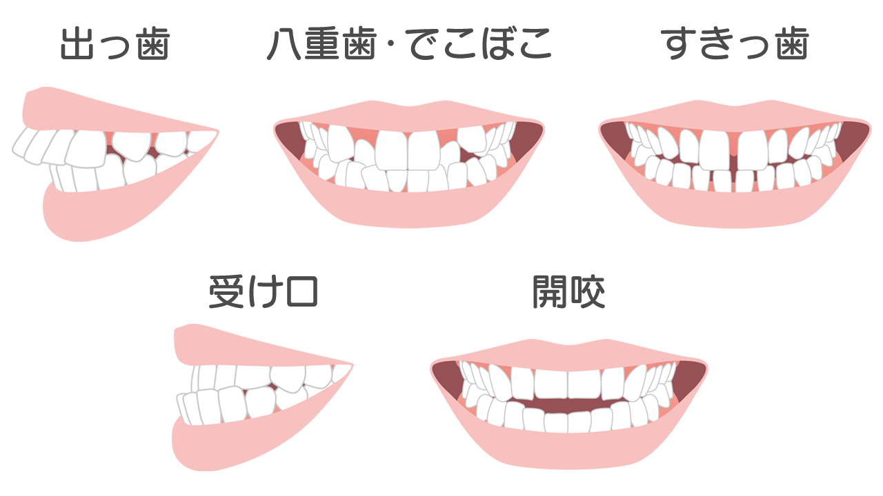 他院で断られた方も ご相談ください - 芦別矯正歯科相談室