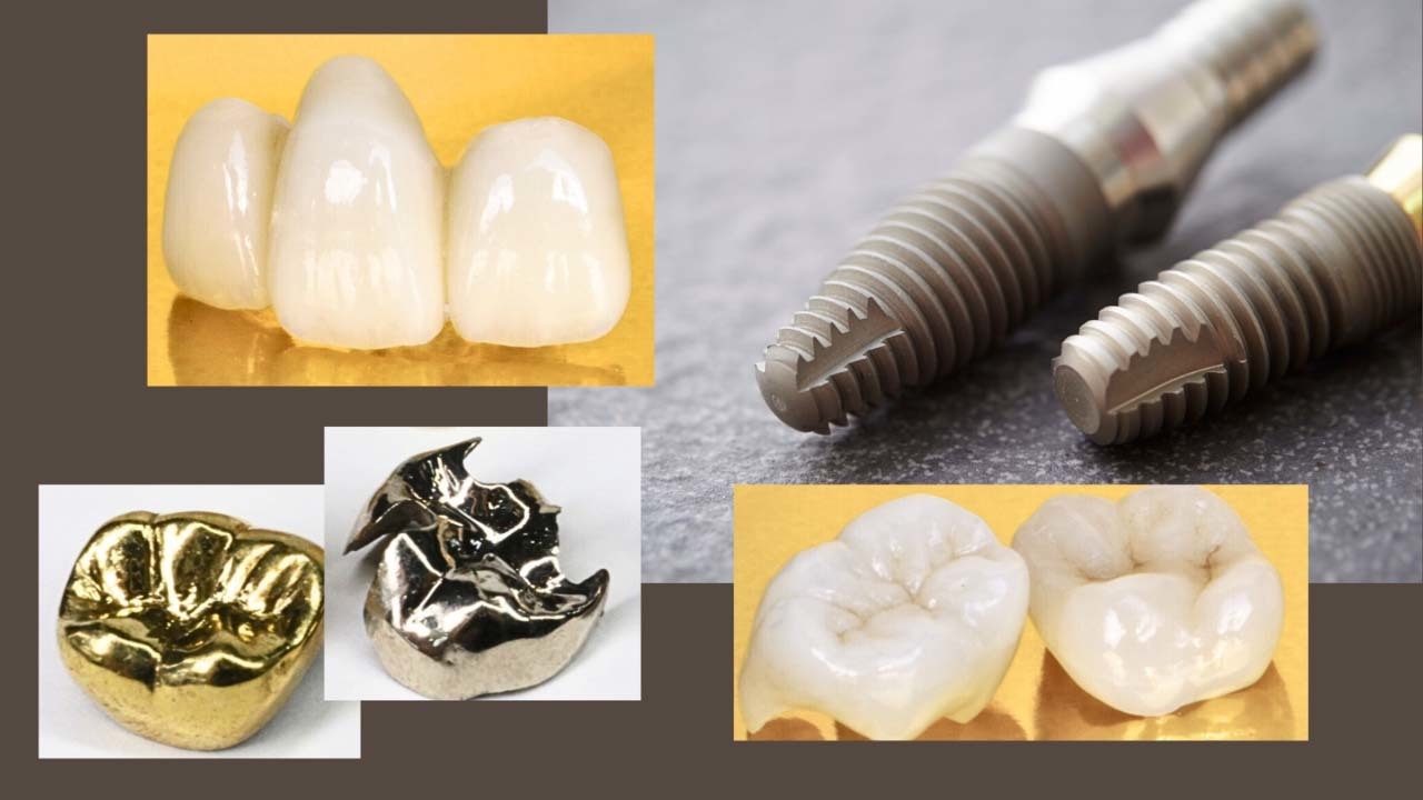 差し歯やブリッジがあっても治療可能-旭川市芦別市 矯正歯科相談室