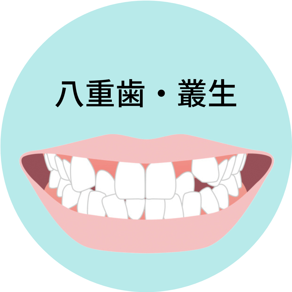 八重歯・叢生- 芦別矯正歯科相談室（旭川・富良野・赤平）