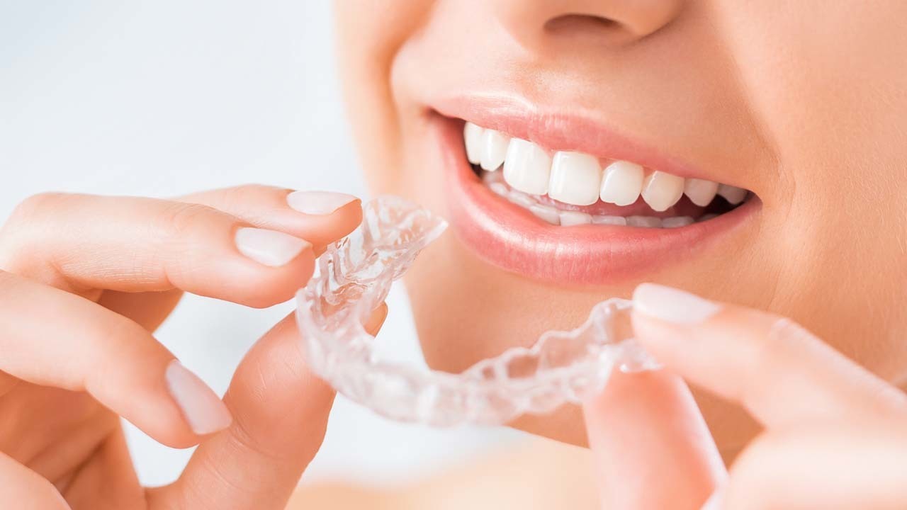 マウスピースは取り外せる - 芦別矯正歯科相談室