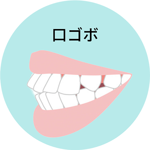 口ゴボ- 芦別矯正歯科相談室（旭川・富良野・赤平）