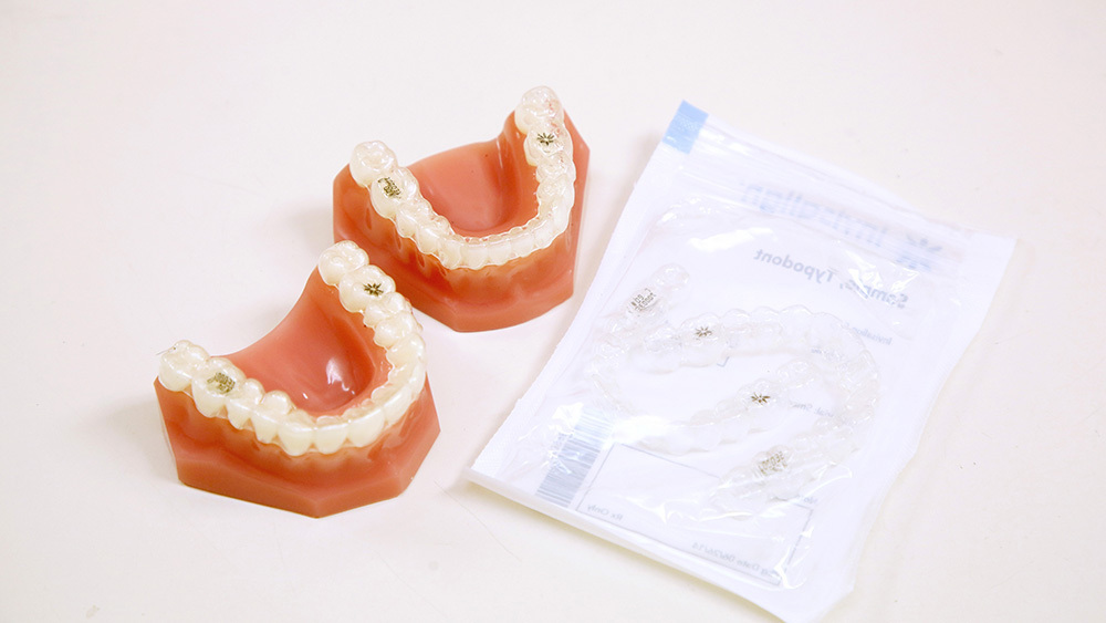 おすすめ歯列矯正の費用と種類 - 芦別矯正歯科相談室（旭川・富良野・赤平）