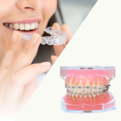 マウスピース矯正は重度の歯並びは適応外 - 芦別矯正歯科相談室